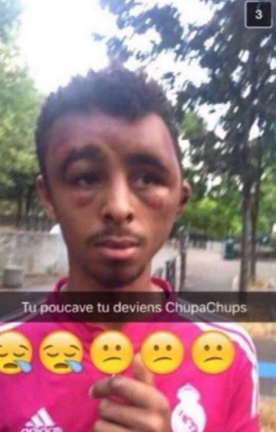 Tu poucaves tu deviens chupa chups, mec défoncé bousillé tabassé, sucette, coquard